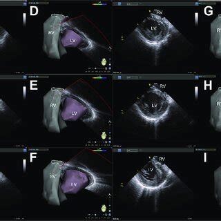 lv imaging|birdeye imaging.